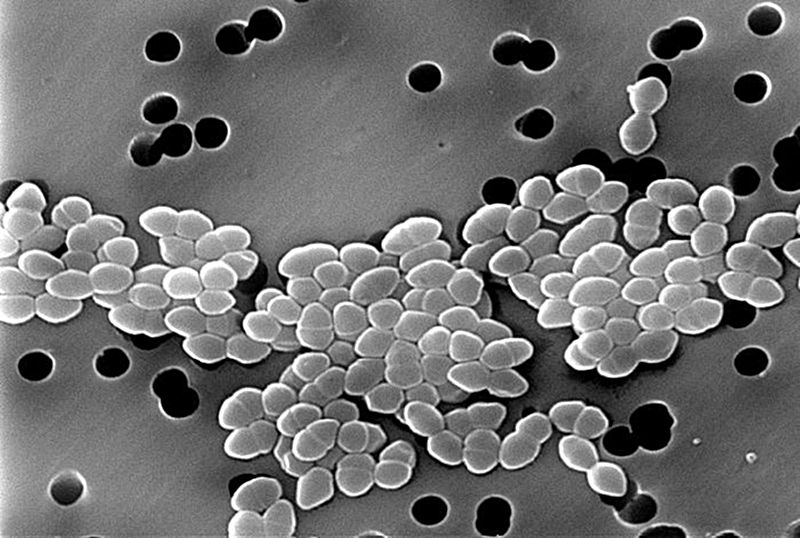 Vancomycin-Resistant Enterococcus,
